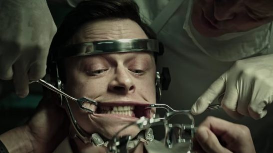 cure_for_toothless_1050_591_81_s_c1